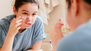 mitos-acne-adolescente